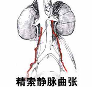 ճҪôԶ뾫в?